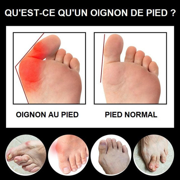 Chaussettes Orthopédiques Anti-oignons
