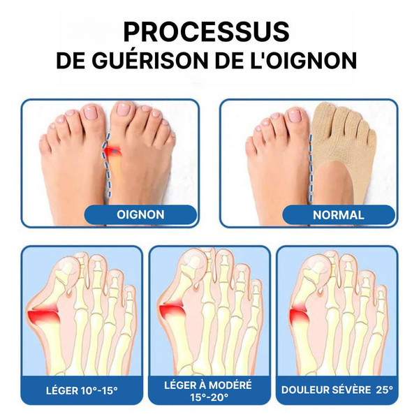 Chaussettes Orthopédiques Anti-oignons