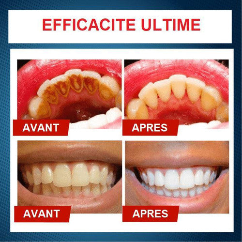 Dentifrice Blanchissant Anti-taches Intense