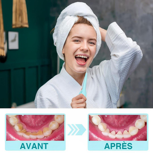 Détartreur Dentaire Professionnel