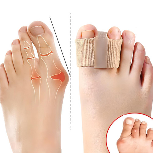 Séparateur d'Orteils Correcteur Hallux Valgus (lot de 2)