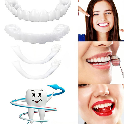 Facettes Dentaires à Clipser