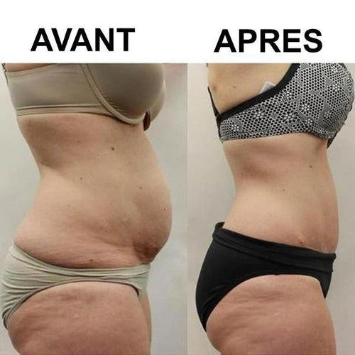 Patchs Minceur Détoxifiant