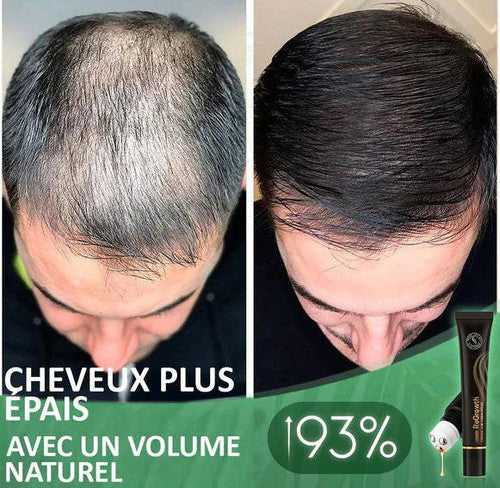 Rouleau De Sérum Capillaire Biologique - HealthCare™