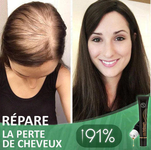 Rouleau De Sérum Capillaire Biologique - HealthCare™