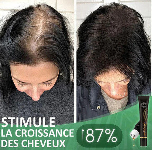 Rouleau De Sérum Capillaire Biologique - HealthCare™