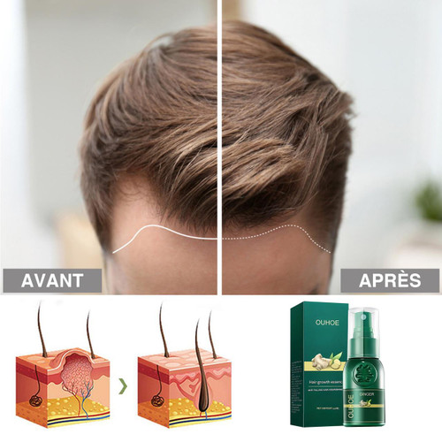 Spray Contre La Perte De Cheveux HealthCare™