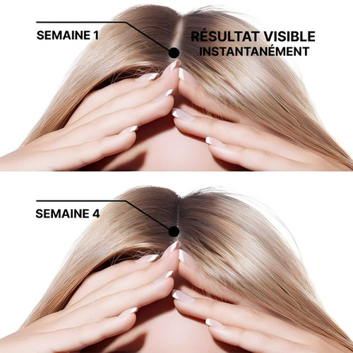 Spray Contre La Perte De Cheveux HealthCare™