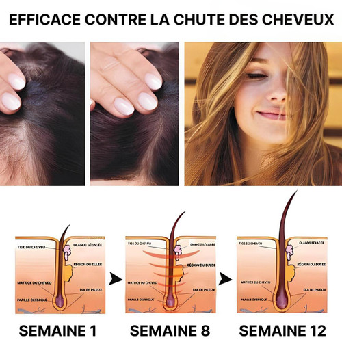 Spray Contre La Perte De Cheveux HealthCare™