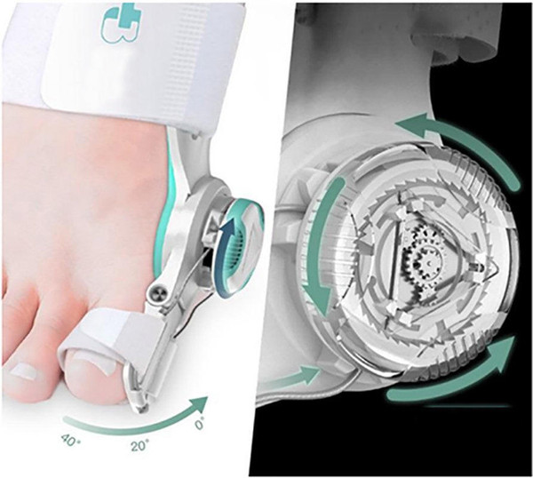 Correcteur Hallux Valgus Efficace - MediCare™