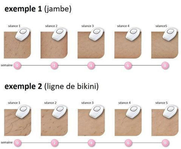 Hair-Off Appareil d'épilation définitive au laser