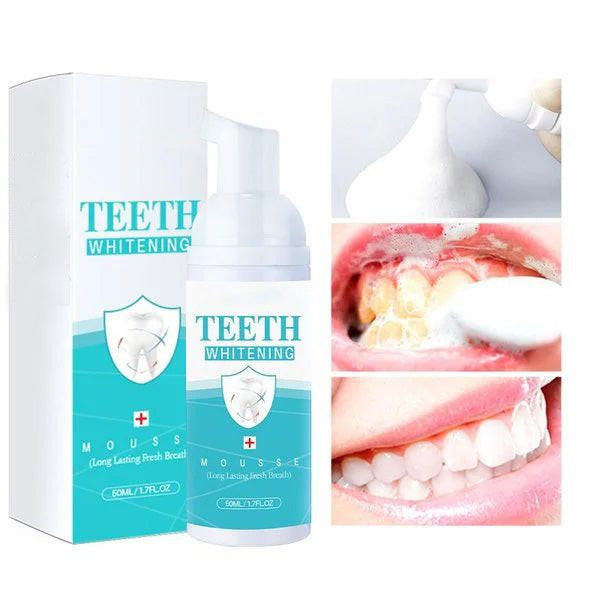 Mousse Blanchiment Dentaire - WhiteCare™