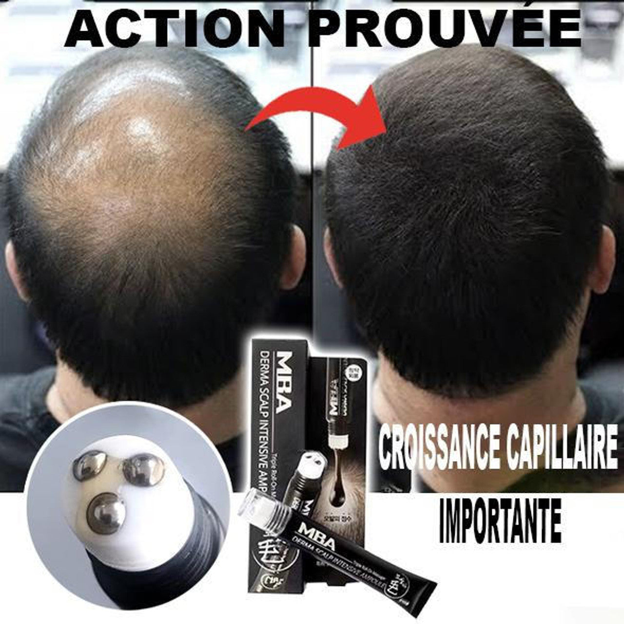 Sérum de repousse des cheveux en Roll-on