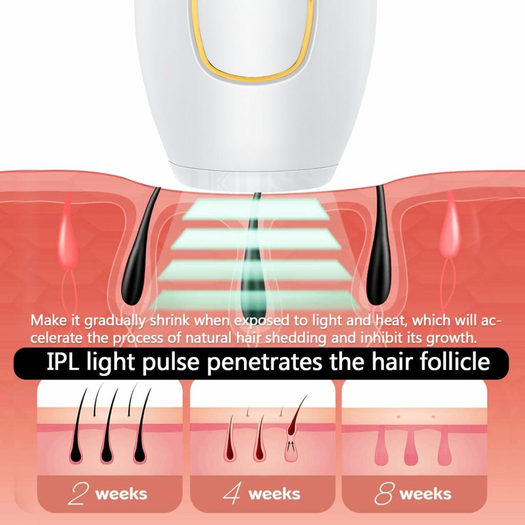 Epilateur Laser IPL