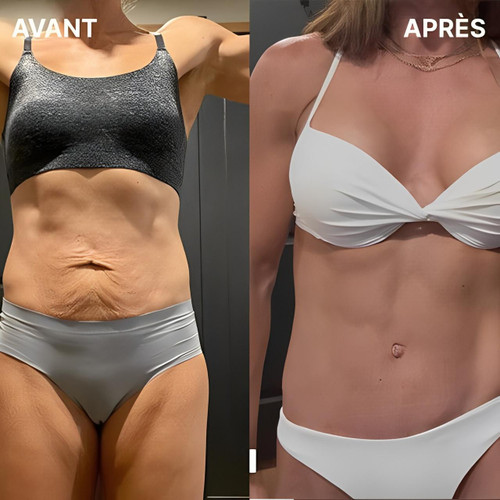 Ceinture Amincissante Luminothérapie LED