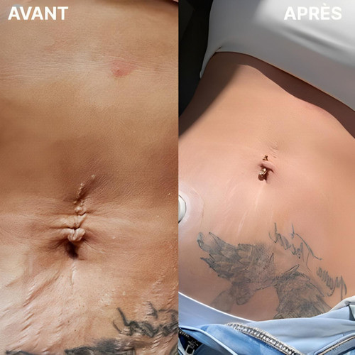 Ceinture Amincissante Luminothérapie LED