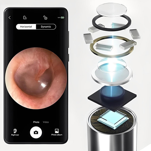 Cure Oreille Avec Caméra Réutilisable