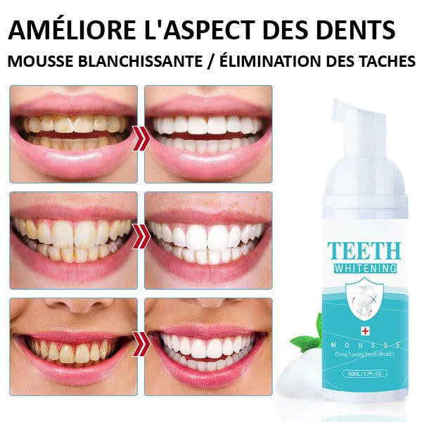 Mousse Blanchiment Dentaire - WhiteCare™